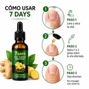 JAYSUING 7Days – Tratamiento Antihongos para Uñas