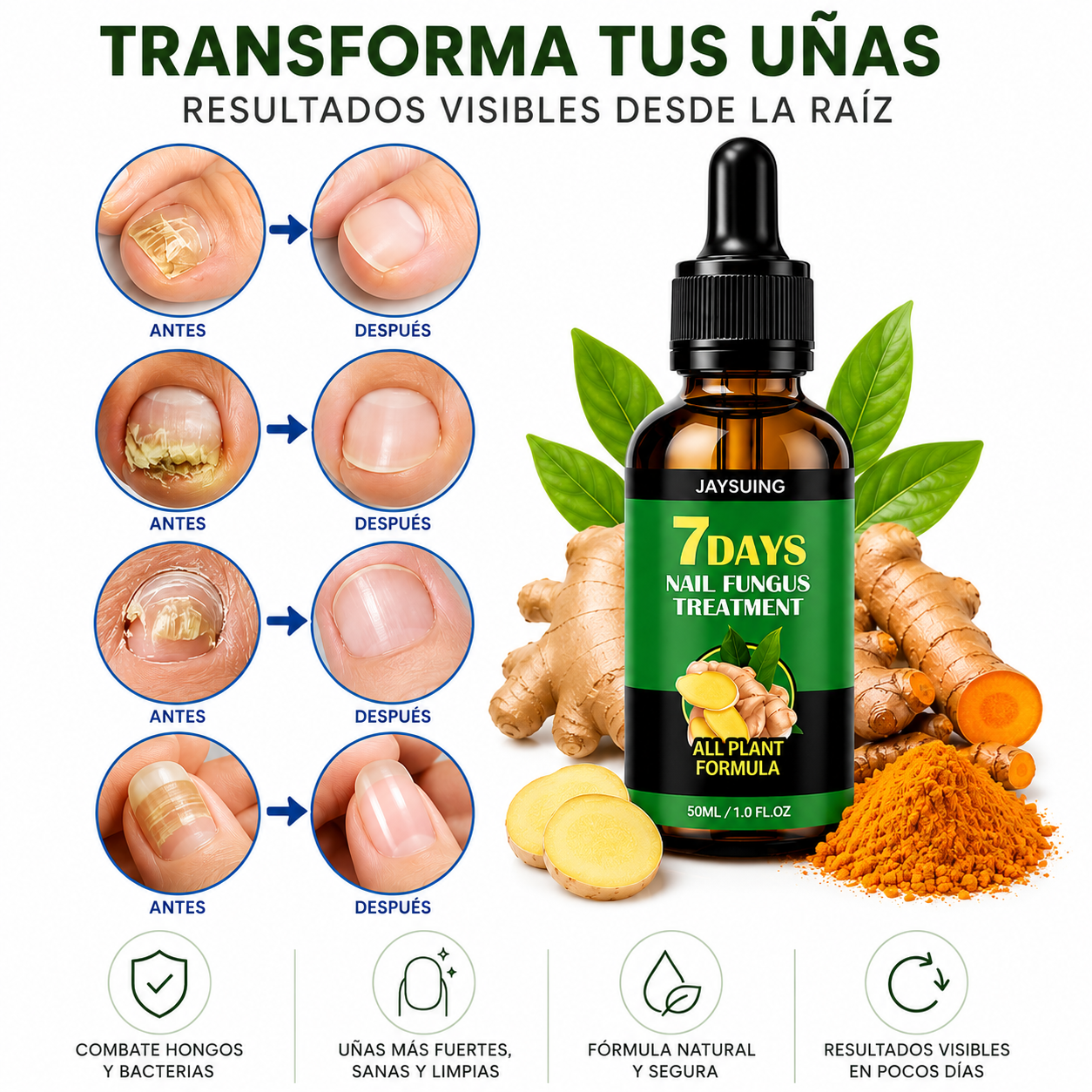 JAYSUING 7Days – Tratamiento Antihongos para Uñas
